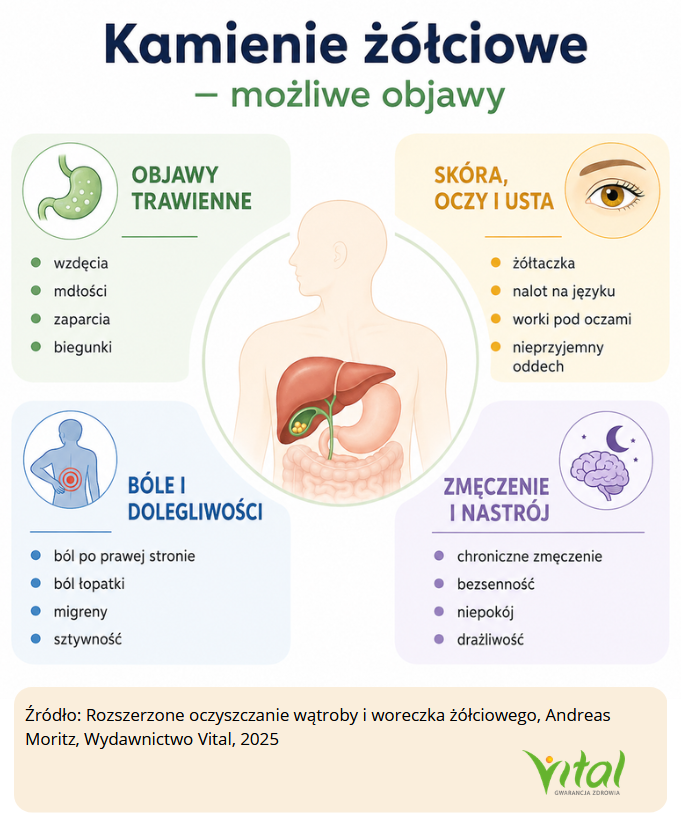 Objawy kamieni żółciowych