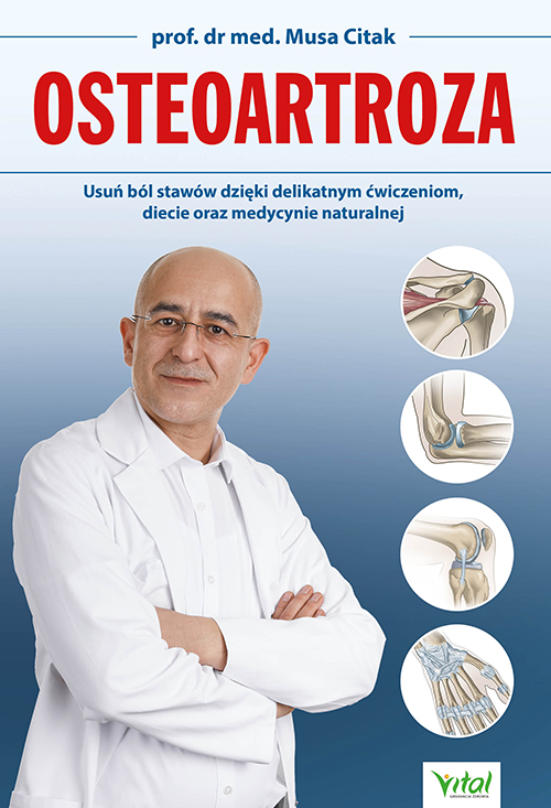 Osteoartroza - Okładka książki